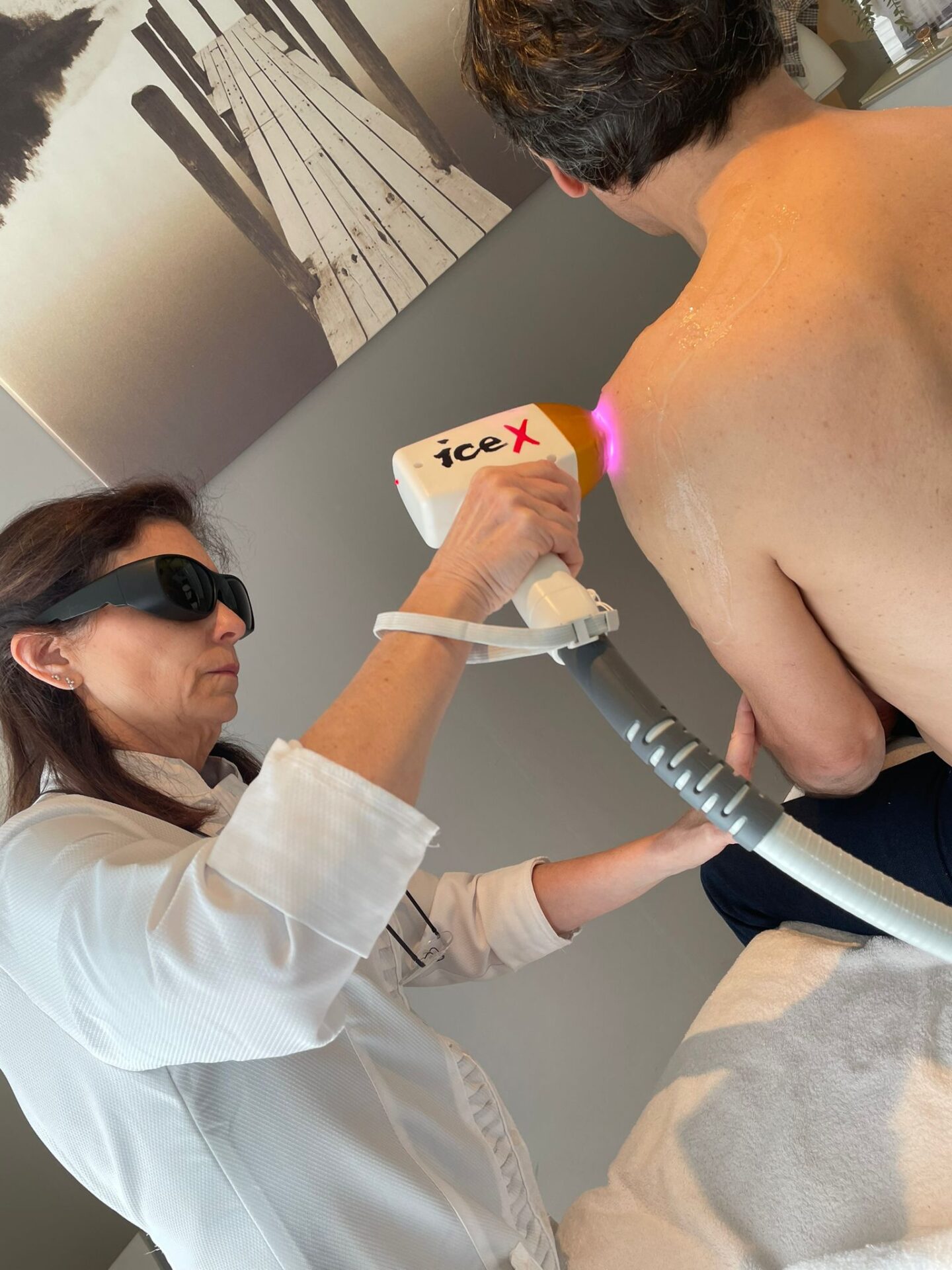 Laserontharing
